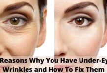 7 Reasons Why You Have Under-Eye Wrinkles and How To Fix Them