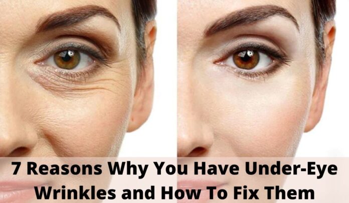 7 Reasons Why You Have Under-Eye Wrinkles and How To Fix Them