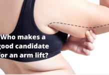 Who makes a good candidate for an arm lift?